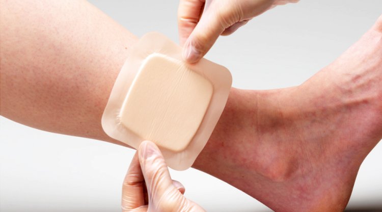 Asia Pacific Advanced Wound Dressings Market to Surpass USD 1.77 Billion by 2028