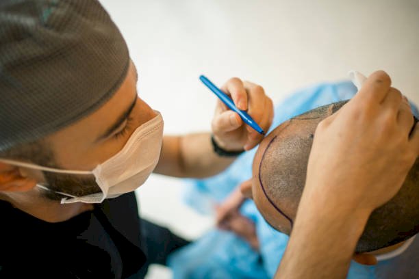 United States Hair Transplant Procedure Market to Witness a CAGR of 22.6% during Forecast Period