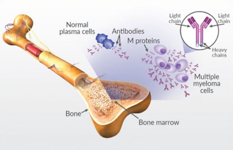 Multiple Myeloma Market Size Grows at Steady CAGR of 5.39%